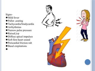 Signs-
Mild fever
Pallor ,seating
Tachycardia/bradycardia
Arrhythmias
Narrow pulse pressure
Raised jvp
Diffuse apical impulses
Soft first heart sound
Pericardial friction rub
Basal crepitations

 