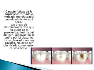 Características de la
superficie: Estriado o
moteado (no glaseado)
cuando el diente está
seco.
Las áreas de
desmineralización que
no están en la
proximidad íntima del
margen gingival; no se
cubre por la placa; es
liso y glaseado; no hay
cavidad. No debe ser
clasificado como lesión
cariosa activa.



 