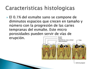 

El 0.1% del esmalte sano se compone de
diminutos espacios que crecen en tamaño y
número con la progresión de las caries
tempranas del esmalte. Este micro
porosidades pueden servir de vías de
erupción.

 