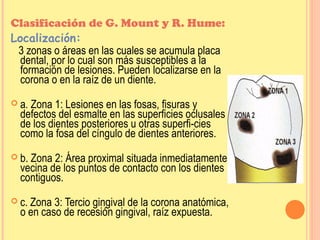 Mount Home Classification System Caries | PPT
