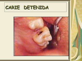 CARIE  DETENIDA 