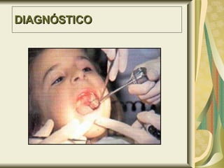 DIAGNÓSTICO 
