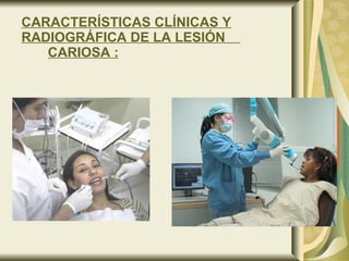 CARACTERÍSTICAS CLÍNICAS Y RADIOGRÁFICA DE LA LESIÓN    CARIOSA : 