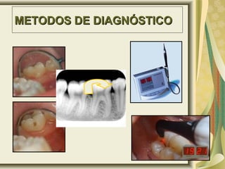 METODOS DE DIAGNÓSTICO
 