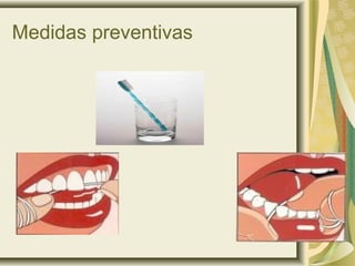 Medidas preventivas
 