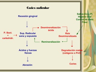 Recesión gingival
Sup. Radicular
sana y expuesta
Ácidos y fuerzas
físicas
Abrasión
Remineralización
Saliva (Ca y P)
Higiene Oral
Control de dieta
Flúor
P. Bact.
+
carbohidr.
Desmineralización
ácida
Raíz
Desmineralizada
Degradación matriz
(colágeno o PnC)
Caries
Caries radicularCaries radicular
 