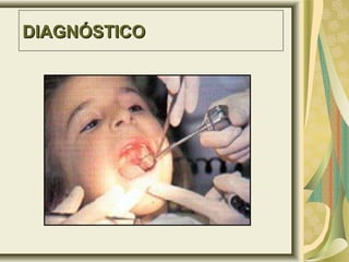 DIAGNÓSTICODIAGNÓSTICO
 