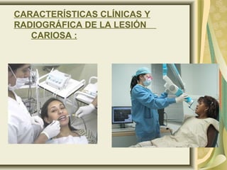 CARACTERÍSTICAS CLÍNICAS Y
RADIOGRÁFICA DE LA LESIÓN
CARIOSA :
 
