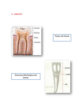V.- ANEXOS
Partes del Diente
Estructura Morfológica del
Diente
 