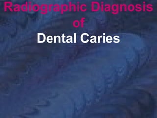 Radiographic Diagnosis
of
Dental Caries
 