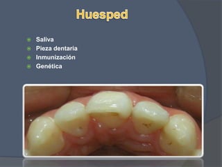 HuespedSaliva Pieza dentariaInmunizaciónGenética