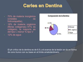Superficies por encima del ecuador dentario.Anusavice KJ. Oper Dent Suppl 2001; 6: 19-26.
