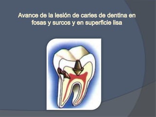 InmunizaciónSe realiza a través de las Inmunoglobulinas presentes en la saliva (IgA), en la sangre (IgM) y respuesta celular mediante linfocitos T.