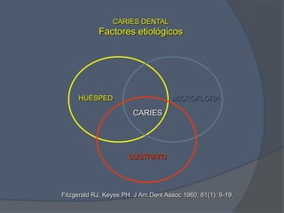 CARIES DENTALFactores etiológicosHUÉSPEDMICROFLORACARIESSUSTRATOFitzgerald RJ, Keyes PH. J Am Dent Assoc 1960; 61(1): 9-19.