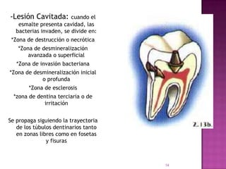 -Lesión Cavitada:       cuando el
   esmalte presenta cavidad, las
  bacterias invaden, se divide en:
 *Zona de destrucción o necrótica
   *Zona de desmineralización
       avanzada o superficial
   *Zona de invasión bacteriana
*Zona de desmineralización inicial
            o profunda
        *Zona de esclerosis
  *zona de dentina terciaria o de
             irritación


Se propaga siguiendo la trayectoria
   de los túbulos dentinarios tanto
   en zonas libres como en fosetas
               y fisuras



                                      14
 