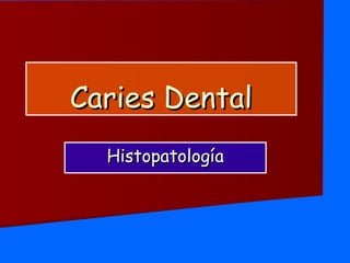 Caries DentalCaries Dental
HistopatologíaHistopatología
 