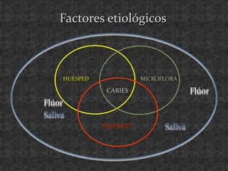 SUSTRATO
CARIES
Factores etiológicos
HUÉSPED MICROFLORA
Flúor
Flúor
Saliva
Saliva
 