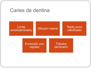 Caries de dentina
Limite
amelodentinario
Difusión lateral
Tejido poco
calcificado
Evolución con
rapidez
Túbulos
dentinario
 