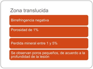 Zona translucida
Birrefringencia negativa
Porosidad de 1%
Perdida mineral entre 1 y 5%
Se observan poros pequeños, de acuerdo a la
profundidad de la lesión
 
