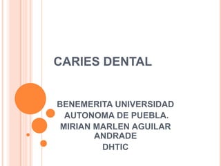 CARIES DENTAL

BENEMERITA UNIVERSIDAD
AUTONOMA DE PUEBLA.
MIRIAN MARLEN AGUILAR
ANDRADE
DHTIC

 