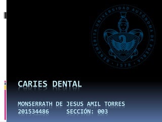 CARIES DENTAL
MONSERRATH DE JESUS AMIL TORRES
201534486 SECCIÓN: 003
 