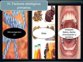 IV. Factores etiológicos
primarios:
Microorganism
os
Dieta
Huésped:
Saliva, diente,
inmunización y
genética.
 