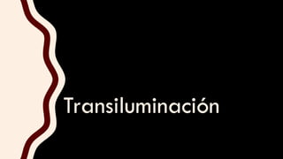 Transiluminación
 