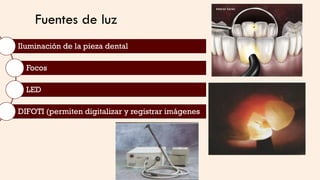 Fuentes de luz
Iluminación de la pieza dental
Focos
LED
DIFOTI (permiten digitalizar y registrar imágenes
 