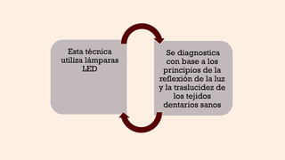 Esta técnica
utiliza lámparas
LED
Se diagnostica
con base a los
principios de la
reflexión de la luz
y la traslucidez de
los tejidos
dentarios sanos
 