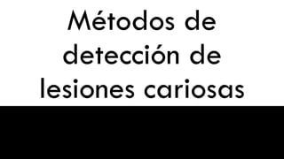 Métodos de
detección de
lesiones cariosas
 
