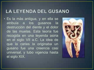• Es la más antigua, y en ella se
atribuía a los gusanos la
destrucción del diente y el dolor
de las muelas. Esta teoría fue
recogida en una leyenda asiria
en el siglo VII a.C. La idea de
que la caries la originaba un
gusano fue una creencia casi
universal, y tubo vigencia hasta
el siglo XIX.
 
