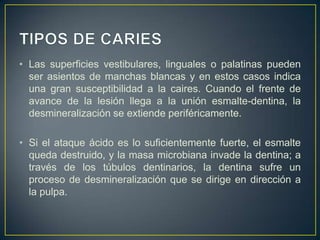 • Las superficies vestibulares, linguales o palatinas pueden
ser asientos de manchas blancas y en estos casos indica
una gran susceptibilidad a la caires. Cuando el frente de
avance de la lesión llega a la unión esmalte-dentina, la
desmineralización se extiende periféricamente.
• Si el ataque ácido es lo suficientemente fuerte, el esmalte
queda destruido, y la masa microbiana invade la dentina; a
través de los túbulos dentinarios, la dentina sufre un
proceso de desmineralización que se dirige en dirección a
la pulpa.
 