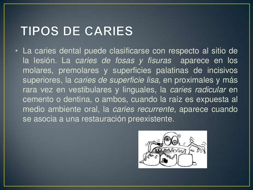 Caries dental cario
