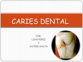 CARIES DENTAL
POR:
LINA PEREZ
Y
ASTRID GAUTA

 