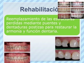 Limitación de la incapacidad.