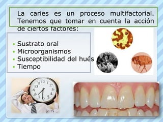 	La caries es un proceso multifactorial. Tenemos que tomar en cuenta la acción de ciertos factores:Sustrato oralMicroorganismosSusceptibilidad del huéspedTiempo
