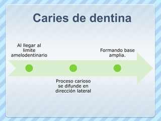 En fosetas y fisuras…