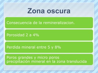 Zona translucida