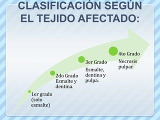 CLASIFICACIÓN POR NÚMERO DE CARAS AFECTADAS EN LOS DIENTES