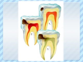 CLASIFICACIÓN SEGÚN EL TEJIDO AFECTADO: