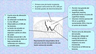 • Primera zona de lesión incipiente.
• Su grosor varÍa entre los 20 y 100 µm
• Grandes grados de desmineralización • Porción mas grande del
esmalte cariado
• Superficie reactiva,
profunda frente a la zona de
superficie intacta .
• Volumen mínimo poroso del
5% en su periferia
aumentando 25% o mas en
el centro de la lesión.
• Tercera zona de alteración
del esmalte.
• Situada por debajo del
cuerpo de la lesión y
superficialmente con
respecto a la zona
translúcida.
• Presente en el 95% de las
lesiones.
• Cuarta zona de alteración
del esmalte.
• Su extensión va desde los
5 a los 100 µm.
• Observable en el 50% de
las lesiones.
• La lesión de esmalte en
esta zona resulta en
espacios o poros en sitios
de unión
• Pérdida mineral del 1.2%
• En base a su peso tiene un
bajo contenido de
carbonato con relativo a
su esmalte sano.
Representación esquemática de la
estructura de los microporos de una
lesión cariosa de esmalte
 