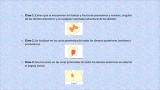 o Clase 1: Caries que se encuentran en fosetas y fisuras de premolares y molares, cíngulos
de los dientes anteriores y en cualquier anomalía estructural de los dientes.
o Clase 2: Se localizan en las caras proximales de todos los dientes posteriores (molares y
premolares).
o Clase 3: Son las caries en las caras proximales de todos los dientes anteriores sin abarcar
el ángulo incisal.
 