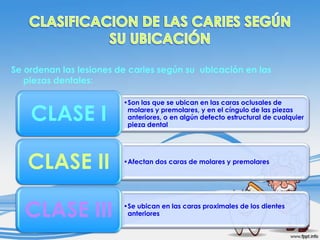 Se ordenan las lesiones de caries según su ubicación en las
piezas dentales:

CLASE I
CLASE II
CLASE III

•Son las que se ubican en las caras oclusales de
molares y premolares, y en el cíngulo de las piezas
anteriores, o en algún defecto estructural de cualquier
pieza dental

•Afectan dos caras de molares y premolares

•Se ubican en las caras proximales de los dientes
anteriores

 