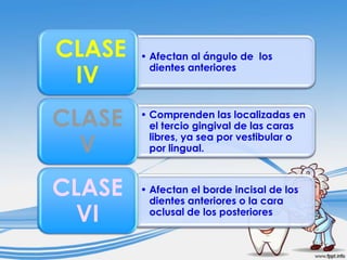 CLASE
IV

• Afectan al ángulo de los
dientes anteriores

CLASE
V

• Comprenden las localizadas en
el tercio gingival de las caras
libres, ya sea por vestibular o
por lingual.

CLASE
VI

• Afectan el borde incisal de los
dientes anteriores o la cara
oclusal de los posteriores

 
