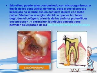 • Esta ultima puede estar contaminada con microorganismos, a
través de los conductillos dentarios, pese a que el proceso
infeccioso no se halle aún en contacto directo con dicha
pulpa. Este hecho se origina debido a que las bacterias
degradan el colágeno a través de las enzimas proteoliticas
que producen , y ensanchan los túbulos dentarios que
permiten así el pasaje de los microorganismos hacia la pulpa

 