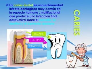 ✽ La caries dental es una enfermedad
infecto contagiosa muy común en
la especie humana , multifactorial
que produce una infección final
destructiva sobre el esmalte, la
dentina y el cemento dentario.
ESMALTE

DENTINA
CEMENTO

 