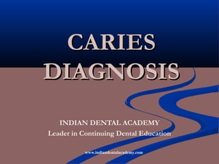 CARIES
DIAGNOSIS
   INDIAN DENTAL ACADEMY
Leader in Continuing Dental Education

           www.indiandentalacademy.com
 