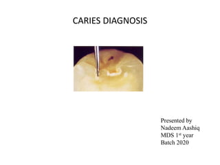 CARIES DIAGNOSIS
Presented by
Nadeem Aashiq
MDS 1st year
Batch 2020
 