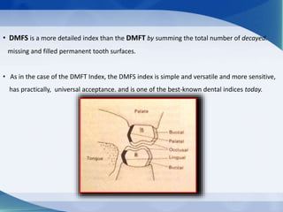 Caries indices | PPTX