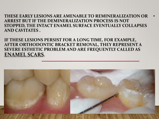 •THESE EARLY LESIONS ARE AMENABLE TO REMINERALIZATION OR
ARREST BUT IF THE DEMINERALIZATION PROCESS IS NOT
STOPPED, THE INTACT ENAMEL SURFACE EVENTUALLY COLLAPSES
AND CAVITATES .
IF THESE LESIONS PERSIST FOR A LONG TIME, FOR EXAMPLE,
AFTER ORTHODONTIC BRACKET REMOVAL, THEY REPRESENT A
SEVERE ESTHETIC PROBLEM AND ARE FREQUENTLY CALLED AS
ENAMEL SCARS.
 